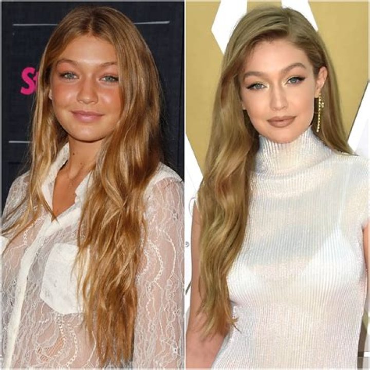 Did Gigi Hadid Get Plastic Surgery?